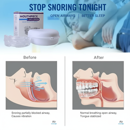 Aussie-Designed Anti Snore Mouthpiece