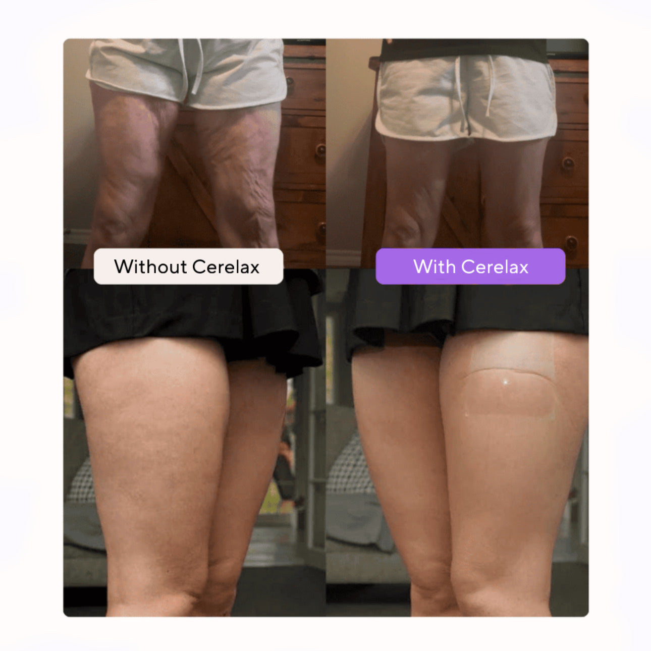 Cerelax™ Invisible Lift & Glow Patches