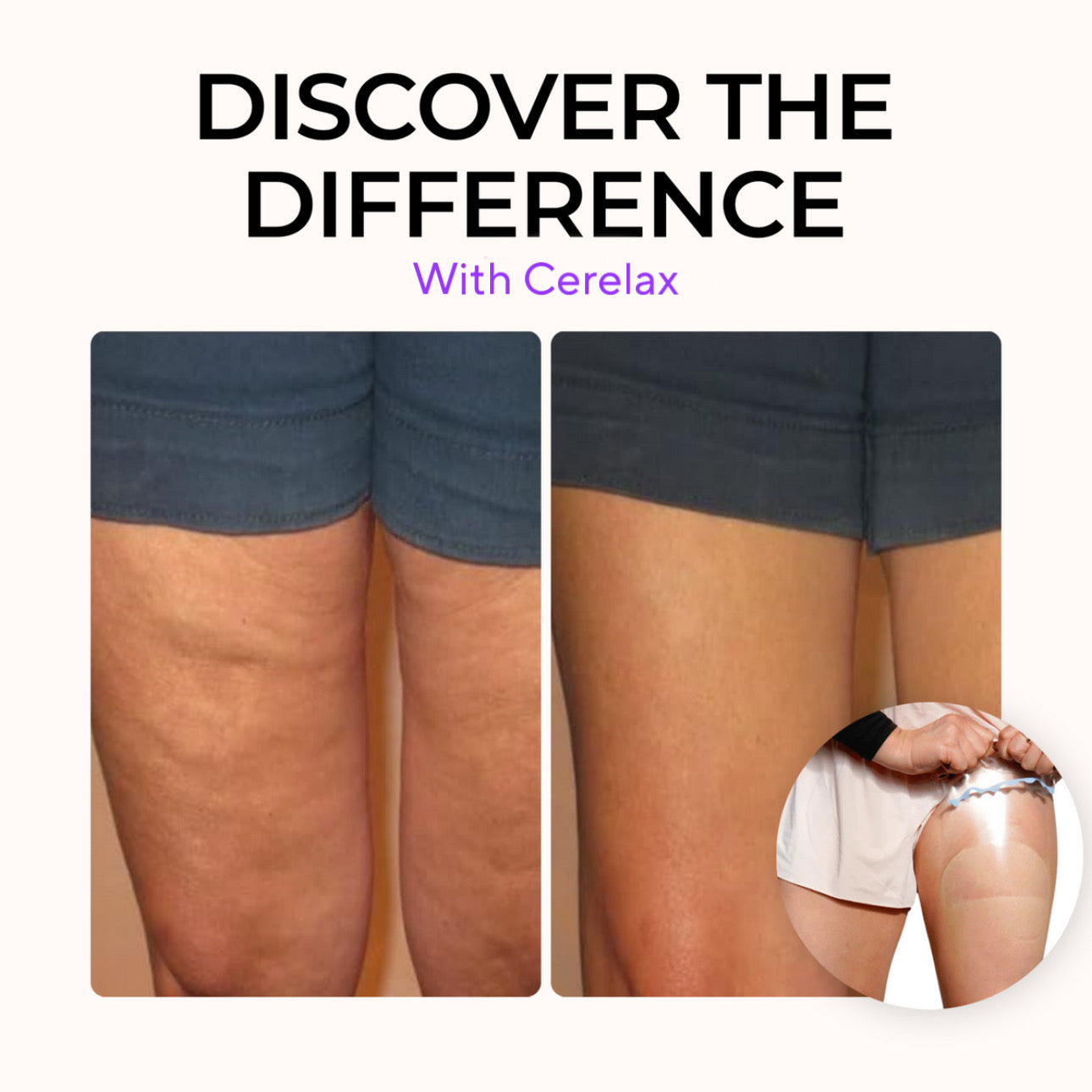 Cerelax™ Invisible Lift & Glow Patches