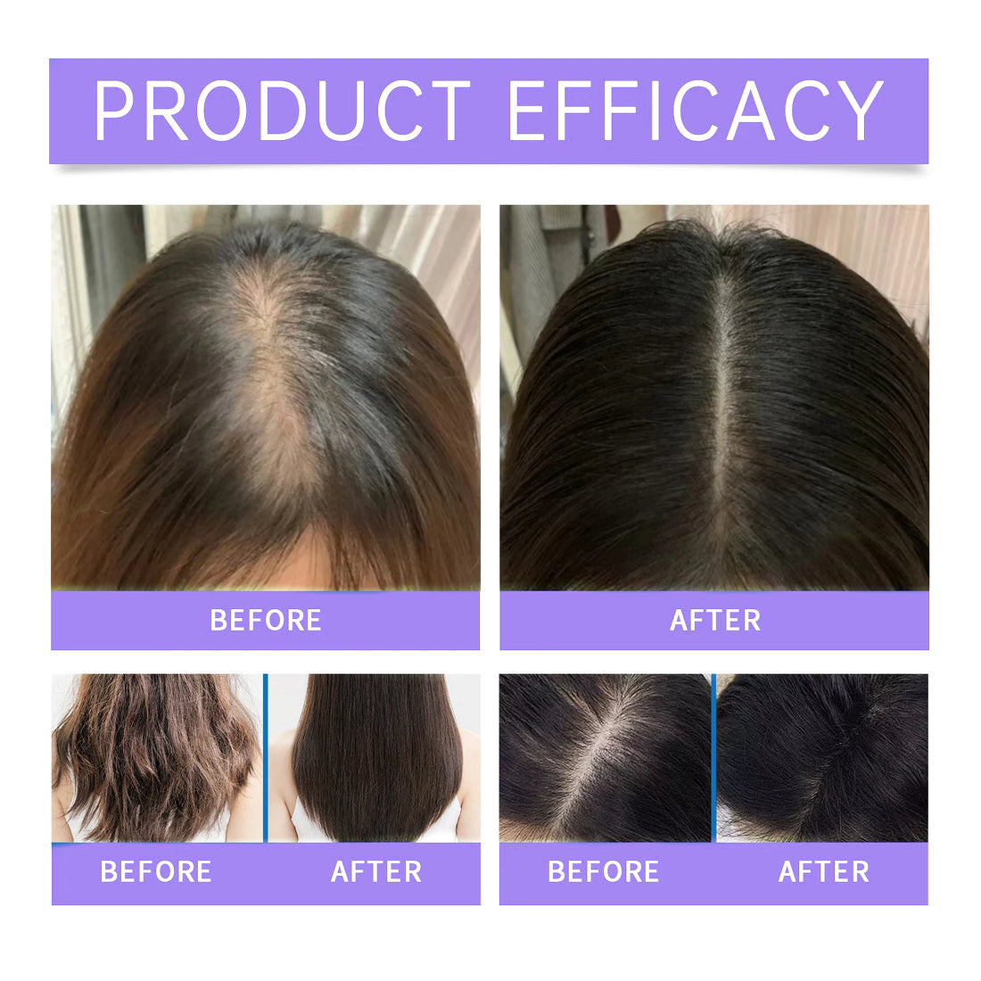 Cerelax™ Hair Growth Roll-On Serum