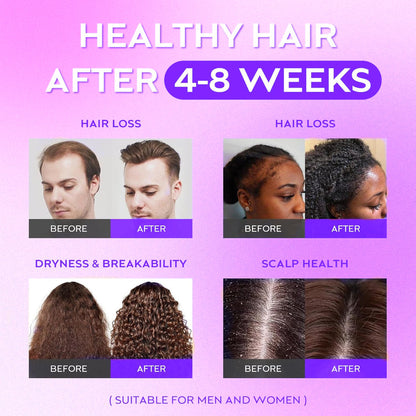 Cerelax™ Hair Growth Roll-On Serum