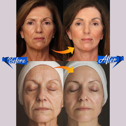 Cerelax™ K-Beauty Anti-Wrinkle Patches Kit