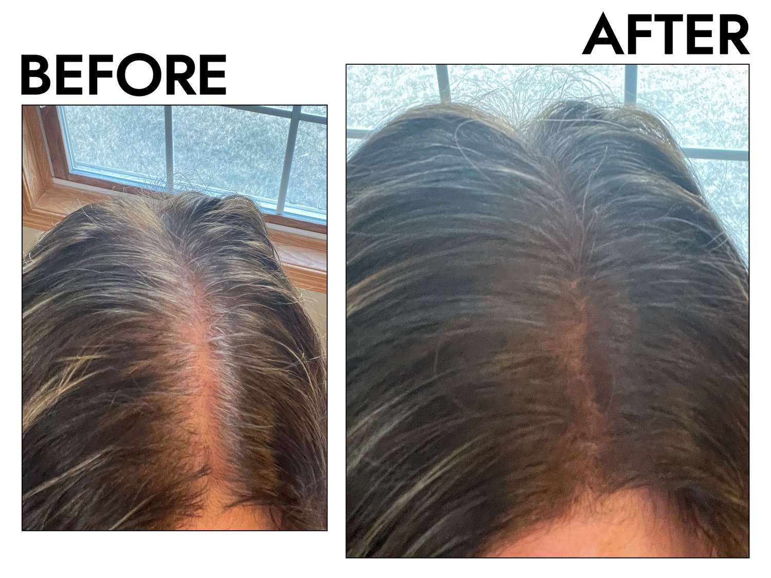 Revitalize Your Confidence with Thicker, Healthier Hair!